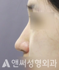 Answer Plastic Surgery case 88: Before