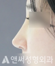 Answer Plastic Surgery case 88: After