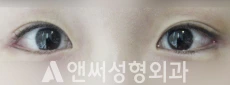 Answer Plastic Surgery case 86: After