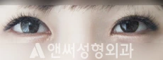 Answer Plastic Surgery case 85: After