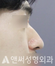 Answer Plastic Surgery case 84: Before