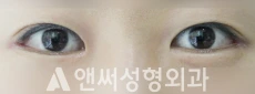 Answer Plastic Surgery case 83: After