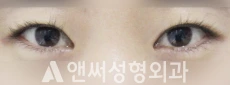 Answer Plastic Surgery case 79: Before