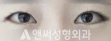 Answer Plastic Surgery case 79: After