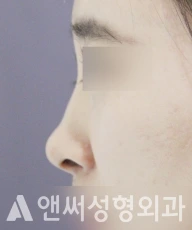 Answer Plastic Surgery case 78: Before