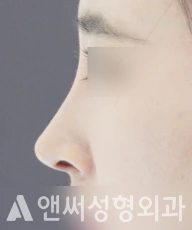 Answer Plastic Surgery case 78: After