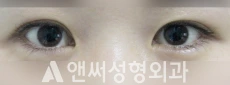 Answer Plastic Surgery case 77: Before