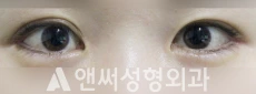 Answer Plastic Surgery case 77: After