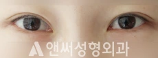 Answer Plastic Surgery case 76: Before