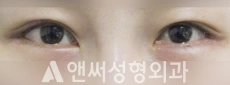 Answer Plastic Surgery case 76: After