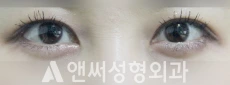 Answer Plastic Surgery case 75: After
