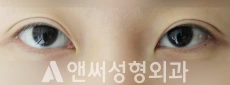 Answer Plastic Surgery case 73: Before