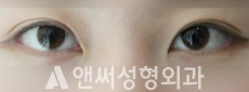 Answer Plastic Surgery case 73: After