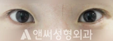 Answer Plastic Surgery case 48: Before