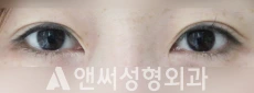 Answer Plastic Surgery case 47: Before