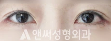 Answer Plastic Surgery case 47: After