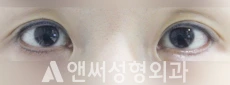 Answer Plastic Surgery case 46: Before