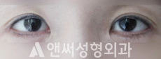 Answer Plastic Surgery case 46: After