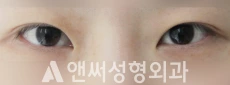 Answer Plastic Surgery case 40: Before