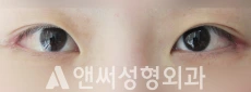 Answer Plastic Surgery case 40: After