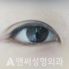 Answer Plastic Surgery case 37: After