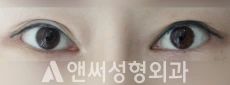 Answer Plastic Surgery case 36: Before