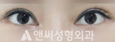 Answer Plastic Surgery case 36: After