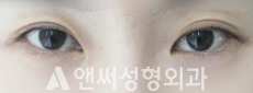Answer Plastic Surgery case 34: Before