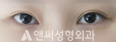 Answer Plastic Surgery case 29: Before