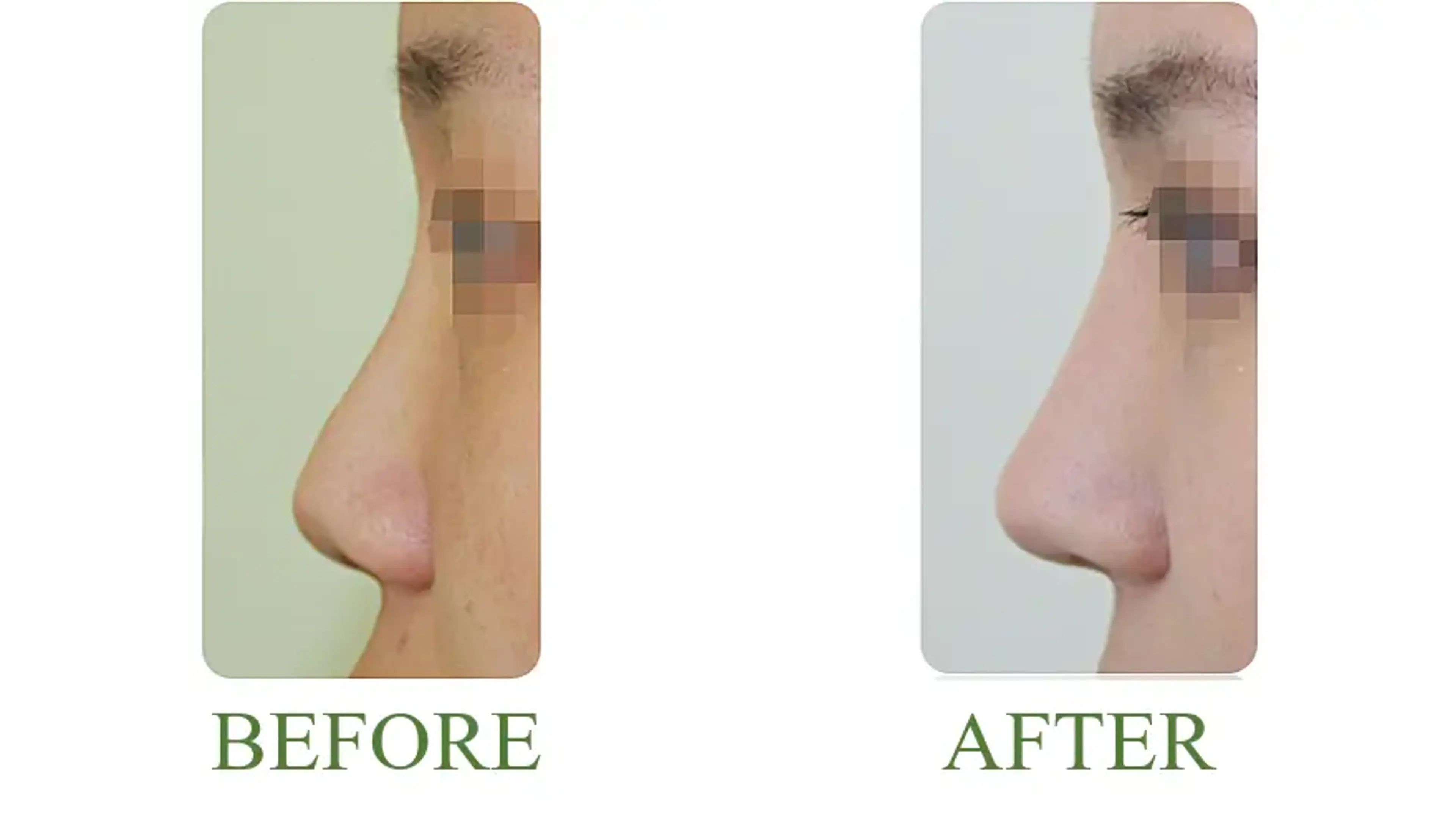 Good-Line Plastic Surgery, clinic-published before and after comparison 10
