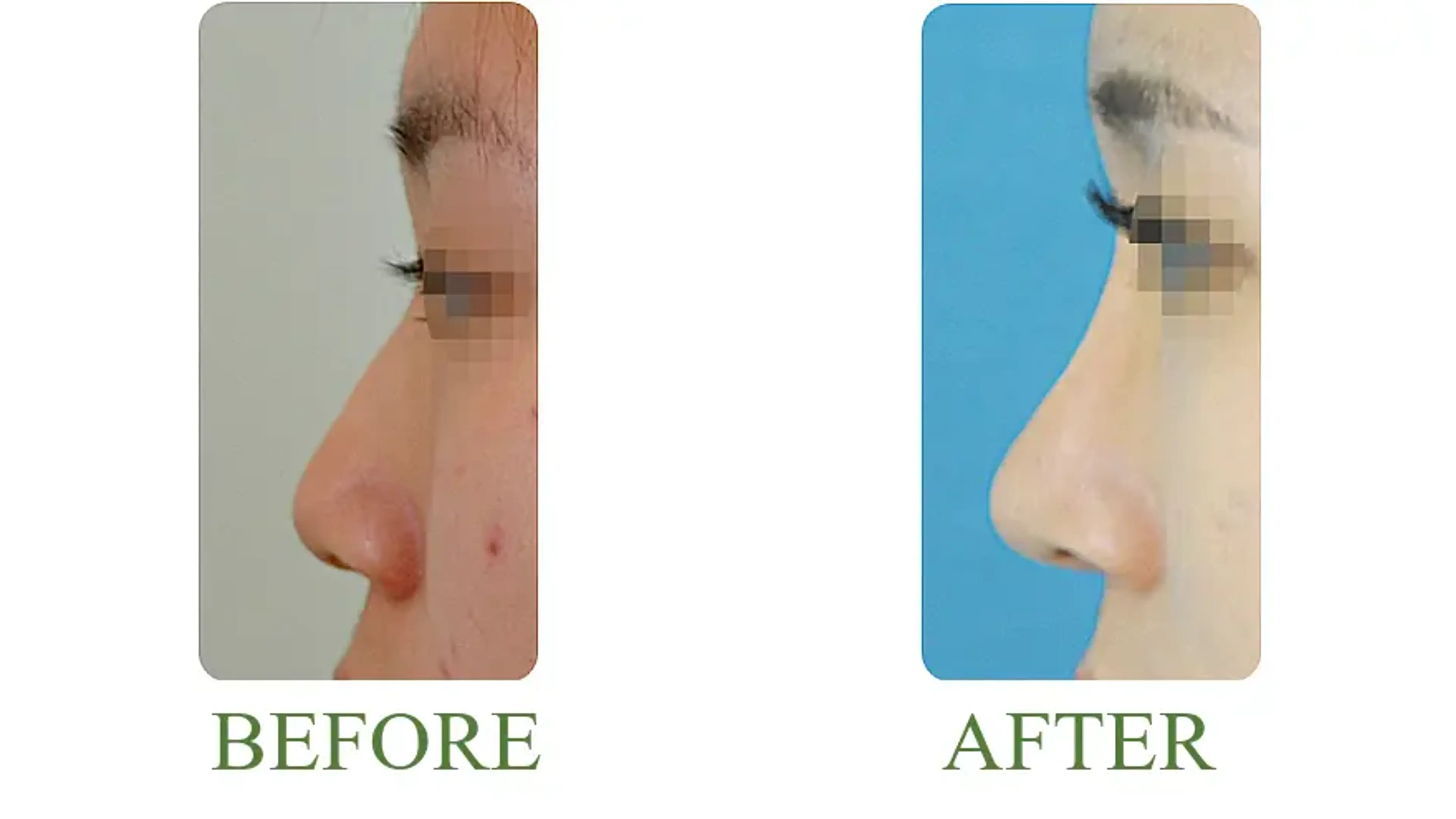 Good-Line Plastic Surgery, clinic-published before and after comparison 11