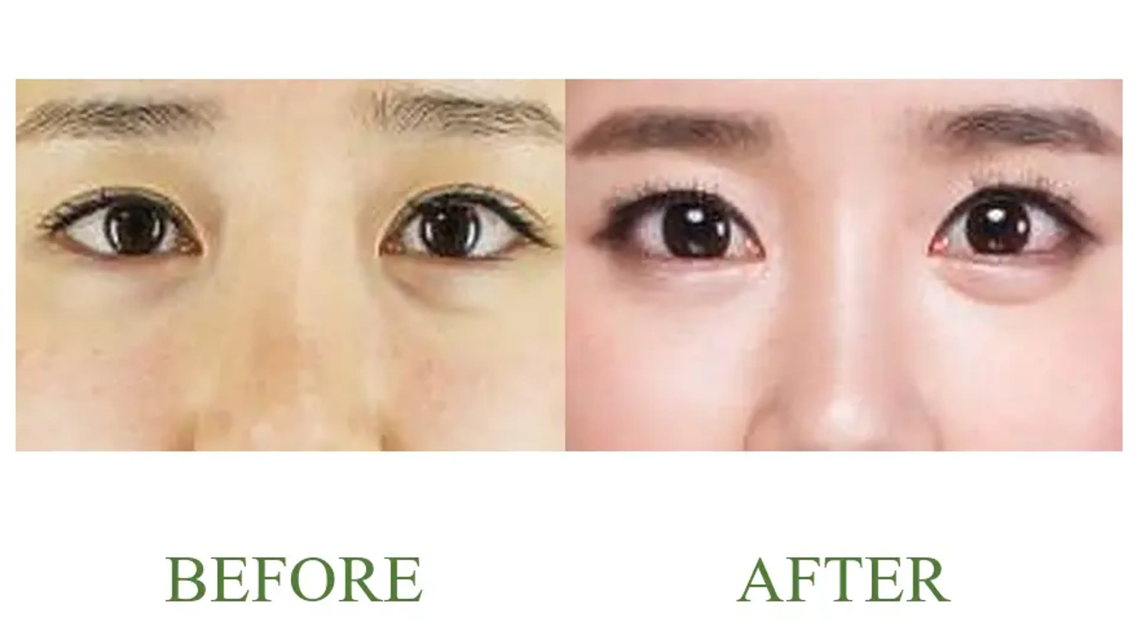 Good-Line Plastic Surgery, clinic-published before and after comparison 7