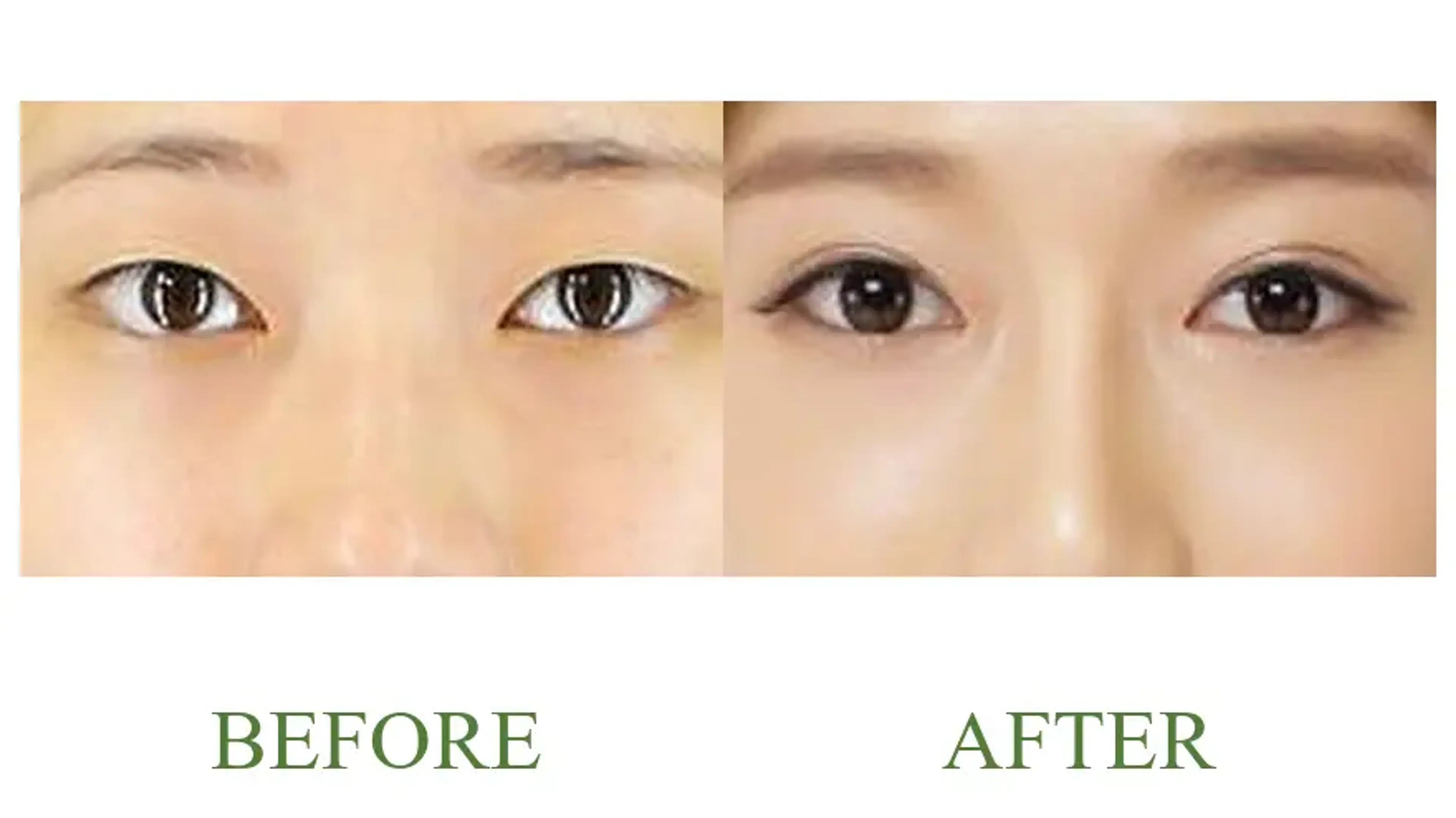 Good-Line Plastic Surgery, clinic-published before and after comparison 8