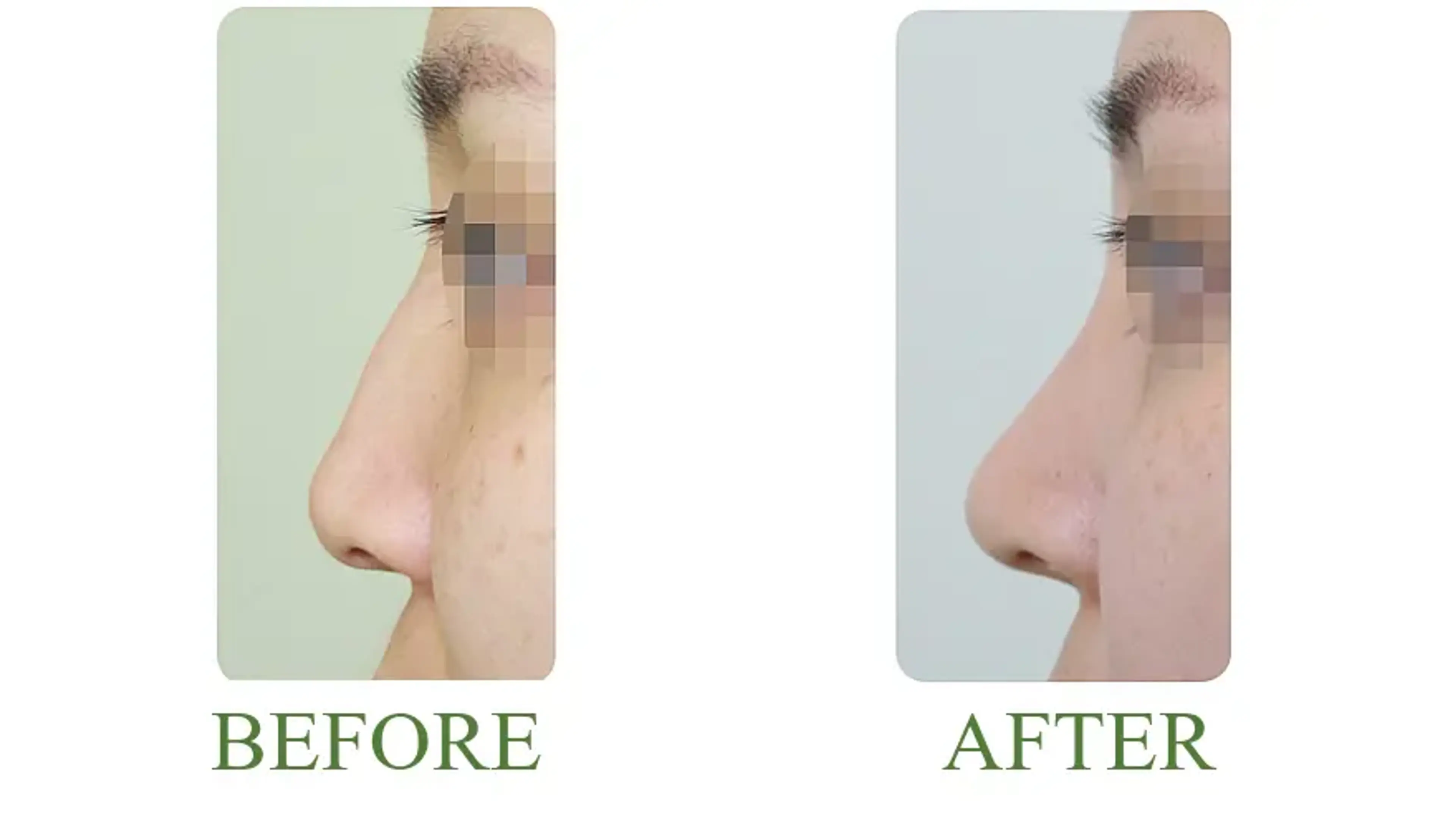 Good-Line Plastic Surgery, clinic-published before and after comparison 9